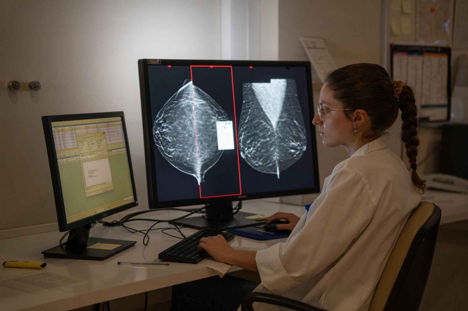 Una especialista analiza las imágenes de una mamografía.